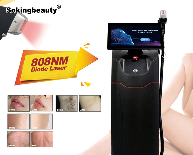 Permanent Hair Removal Laser 808nm
